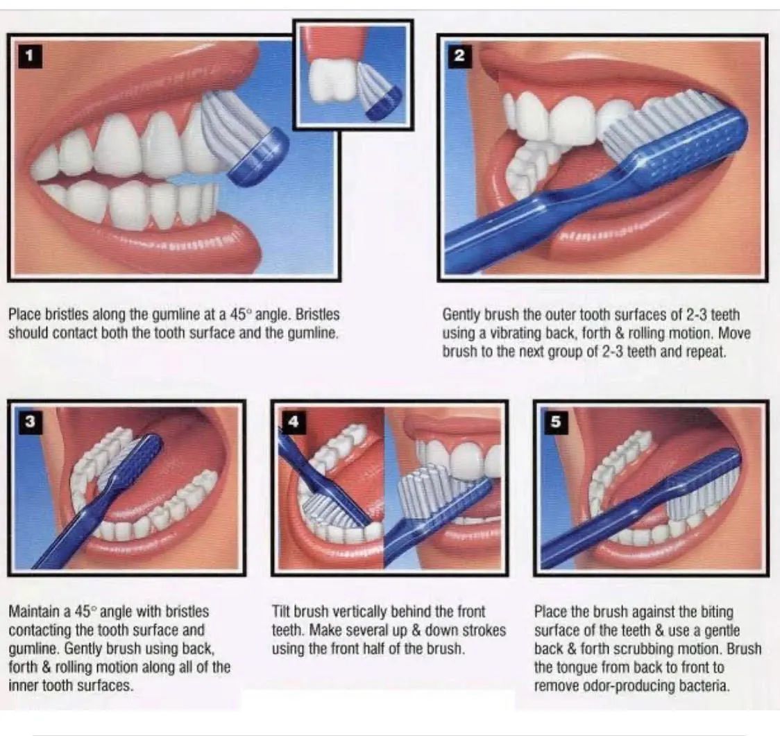 Step by step pictures on how to brush your teeth